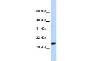 WB Suggested Anti-TPD52L3 Antibody Titration: 0. (TPD52L3 Antikörper  (Middle Region))