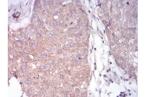 Immunohistochemistry (IHC) image for anti-phospholipase C, gamma 1 (PLCG1) (AA 1192-1291) antibody (ABIN5542680)