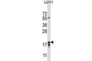 Western Blotting (WB) image for anti-Cancer/testis Antigen 2 (CTAG2) antibody (ABIN2997526) (CTAG2 Antikörper)