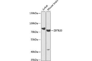 Western blot analysis of extracts of various cell lines, using ZBTB20 antibody (ABIN6130809, ABIN6150372, ABIN6150373 and ABIN6223978) at 1:1000 dilution. (ZBTB20 Antikörper  (AA 100-400))