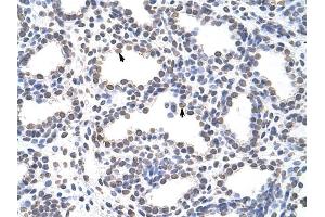 CARS antibody was used for immunohistochemistry at a concentration of 4-8 ug/ml to stain Alveolar cells (arrows) in Human Lung. (CARS Antikörper  (C-Term))