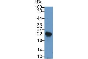 Detection of LIF in Rat Spleen lysate using Polyclonal Antibody to Leukemia Inhibitory Factor (LIF) (LIF Antikörper  (AA 2-201))