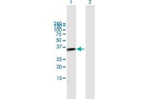 Western Blot analysis of C2 expression in transfected 293T cell line by C2 MaxPab polyclonal antibody. (Complement C2 Antikörper  (AA 20-328))