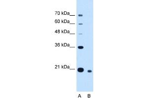 WB Suggested Anti-CDCA4 Antibody Titration:  2. (CDCA4 Antikörper  (N-Term))