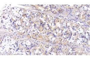Detection of IL13 in Porcine Stomach Tissue using Polyclonal Antibody to Interleukin 13 (IL13) (IL-13 Antikörper  (AA 25-131))