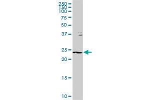 GSTZ1 MaxPab rabbit polyclonal antibody. (GSTZ1 Antikörper  (AA 1-216))