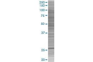 HYAL1 transfected lysate. (HYAL1 293T Cell Transient Overexpression Lysate(Denatured))