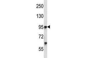 Tie1 antibody western blot analysis in K562 lysate. (TIE1 Antikörper  (AA 361-389))