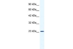 WB Suggested Anti-KCTD11 Antibody Titration:  1. (KCTD11 Antikörper  (N-Term))