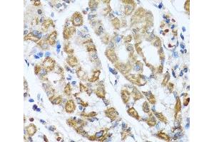 Immunohistochemistry of paraffin-embedded Human stomach using ANTXR2 Polyclonal Antibody at dilution of 1:100 (40x lens). (ANTXR2 Antikörper)