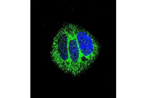 Confocal immunofluorescent analysis of RARA Antibody (C-term) (ABIN657770 and ABIN2846746) with MCF-7 cell followed by Alexa Fluor® 488-conjugated goat anti-rabbit lgG (green). (Retinoic Acid Receptor alpha Antikörper  (C-Term))