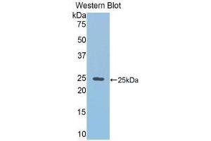 Western Blotting (WB) image for anti-RalA Binding Protein 1 (RALBP1) (AA 192-380) antibody (ABIN1860399) (RALBP1 Antikörper  (AA 192-380))