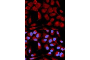 Immunofluorescence (IF) image for anti-Pyruvate Dehydrogenase (Lipoamide) alpha 1 (PDHA1) (AA 30-390) antibody (ABIN3023697) (PDHA1 Antikörper  (AA 30-390))
