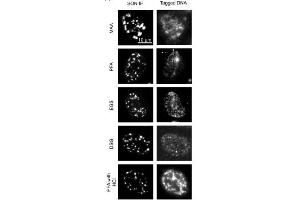Images comparing the SON (a marker for nuclear speckles) immunofluorescence (IF) images (left panels) in different fixation conditions (MAA, methanol/acetic acid, 1% PFA; EGS, ethylene glycol bis(succinimidyl succinate); DSG, disuccinimidyl glutarate, 1% PFA followed by 0. (SON Antikörper  (N-Term))