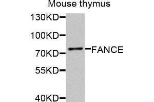 Western blot analysis of extracts of mouse thymus, using FANCE antibody (ABIN5974901) at 1/1000 dilution. (FANCE Antikörper)