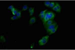 Immunofluorescence staining of HepG2 cells with ABIN7171189 at 1:400, counter-stained with DAPI. (Syndecan 1 Antikörper  (AA 23-254))