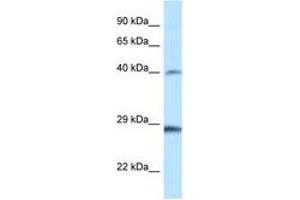 Image no. 1 for anti-Homeobox B9 (HOXB9) (AA 20-69) antibody (ABIN6747415) (HOXB9 Antikörper  (AA 20-69))