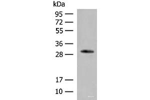 Western blot analysis of Human left thymus tissue lysate using VDAC3 Polyclonal Antibody at dilution of 1:200 (VDAC3 Antikörper)
