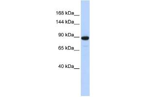 WB Suggested Anti-PDE3A Antibody Titration:  0. (PDE3A Antikörper  (N-Term))
