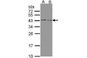 WB Image Sample(30 μg of whole cell lysate) A:HeLa S3 , B:MOLT4, 12% SDS PAGE antibody diluted at 1:500 (HSD3B2 Antikörper)