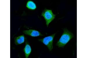 IF analysis of ENO3 using anti-ENO3 antibody (ABIN7601973).