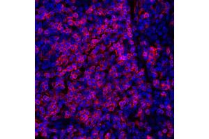 Immunofluorescence (IF) image for anti-CD247 Molecule (CD247) (C-Term) antibody (ABIN7455240) (Rekombinanter CD247 Antikörper  (C-Term))