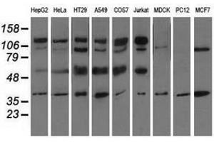Image no. 2 for anti-CD5 (CD5) antibody (ABIN1497337) (CD5 Antikörper)