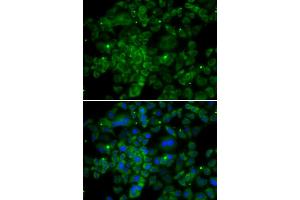 Immunofluorescence analysis of MCF-7 cells using CCL2 antibody (ABIN5974379).
