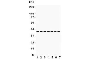 Western blot testing of Nucleophosmin antibody and Lane 1:  rat testis (NPM1 Antikörper  (AA 1-294))