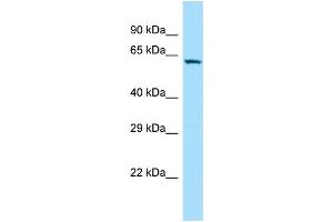 WB Suggested Anti-SOWAHC Antibody Titration: 1. (ANKRD57 Antikörper  (N-Term))