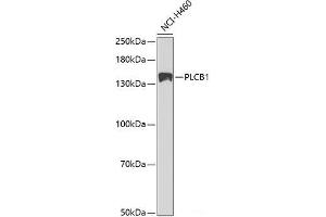 Phospholipase C beta 1 Antikörper