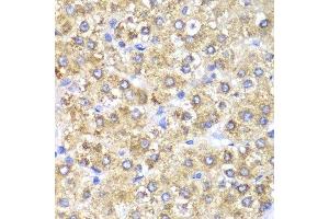 Immunohistochemistry (Paraffin-embedded Sections) (IHC (p)) image for anti-serine Hydroxymethyltransferase 2 (Mitochondrial) (SHMT2) (AA 265-504) antibody (ABIN3021747)