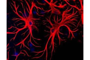 Immunofluorescence Microscopy of Anti-Glial Fibrillary Acidic Protein (GFAP) (Chicken) Antibody Immunofluorescence Microscopy of Anti-Glial Fibrillary Acidic Protein (GFAP) (Chicken) Antibody.