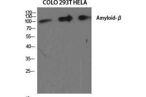 Western Blot (WB) analysis of specific cells using Amyloid-beta Polyclonal Antibody.