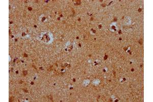 IHC image of ABIN7172561 diluted at 1:400 and staining in paraffin-embedded human brain tissue performed on a Leica BondTM system. (HES5 Antikörper  (AA 1-166))