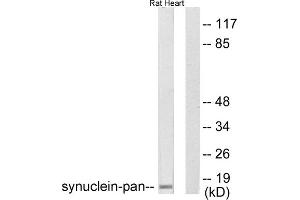 Western blot analysis of extracts from rat heart, using Synuclein-pan antibody (ABIN5976513). (Synuclein Antikörper  (N-Term, pan))