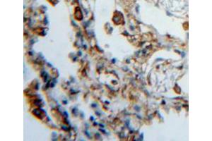 IHC-P analysis of lung tissue, with DAB staining. (HPSE Antikörper  (AA 419-535))