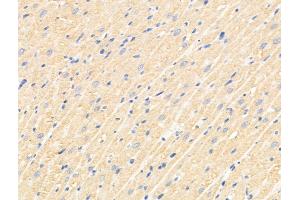 ABIN6265768 and ABIN6269034 at 1/100 staining Rat pancreatic tissue by IHC-P. (TNFAIP6 Antikörper  (N-Term))