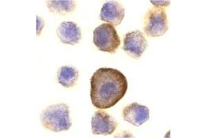 Immunohistochemistry (IHC) image for anti-TP53 Apoptosis Effector (PERP) (C-Term) antibody (ABIN1030575) (PERP Antikörper  (C-Term))