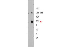 Image no. 1 for anti-ATP-Binding Cassette, Sub-Family B (MDR/TAP), Member 5 (ABCB5) (Internal Region) antibody (ABIN401434) (ABCB5 Antikörper  (Internal Region))