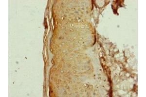 Immunohistochemistry of paraffin-embedded human skin tissue using ABIN7144350 at dilution of 1:100 (AP1M1 Antikörper  (AA 1-160))