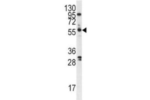 Western blot analysis of PLK antibody and A375 cell lysate. (PLK1 Antikörper  (AA 573-603))