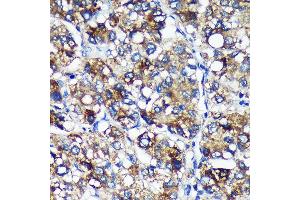 Immunohistochemistry (IHC) image for anti-Pyrroline-5-Carboxylate Reductase Family, Member 2 (PYCR2) (AA 271-320) antibody (ABIN7269766)