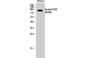 Western Blotting (WB) image for anti-K(lysine) Acetyltransferase 2B (KAT2B) (acLys428) antibody (ABIN3179010) (KAT2B Antikörper  (acLys428))