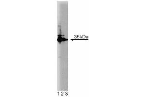 Western blot analysis of HAX-1 on Jurkat cell lysate. (HAX1 Antikörper  (AA 10-148))