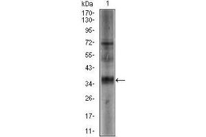 Western blot analysis using SRY mouse mAb against NTERA-2 (1) cell lysate. (SRY Antikörper  (AA 1-204))