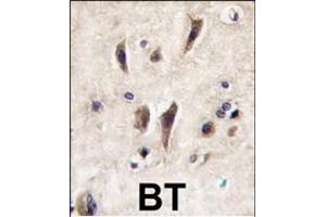Formalin-fixed and paraffin-embedded human brain tissue reacted with TIE antibody (N-term), which was peroxidase-conjugated to the secondary antibody, followed by DAB staining. (TIE1 Antikörper  (N-Term))