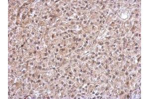 IHC-P Image Immunohistochemical analysis of paraffin-embedded HBL435 xenograft, using TrxR1, antibody at 1:500 dilution. (TXNRD1 Antikörper)