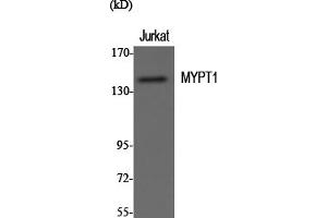 Western Blotting (WB) image for anti-Myosin Phosphatase, Target Subunit 1 (PPP1R12A) (Thr696) antibody (ABIN5957178) (PPP1R12A Antikörper  (Thr696))