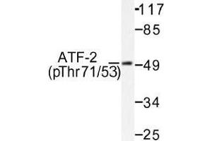 Image no. 1 for anti-Activating Transcription Factor 2 (ATF2) (pThr53), (pThr71) antibody (ABIN317966) (ATF2 Antikörper  (pThr53, pThr71))